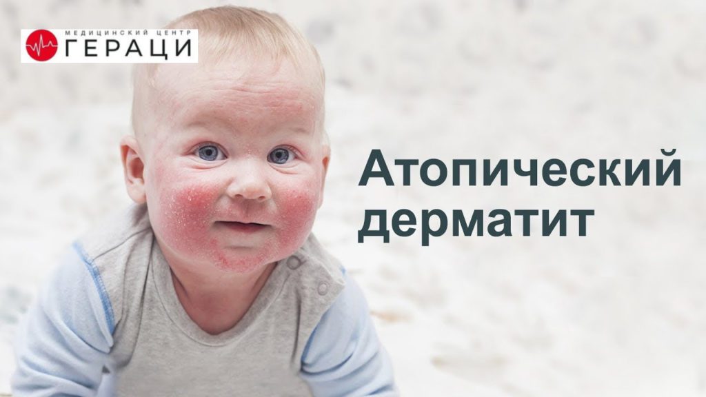 kak vybrat letnyuyu odezhdu dlya detey s atopicheskim dermatitom