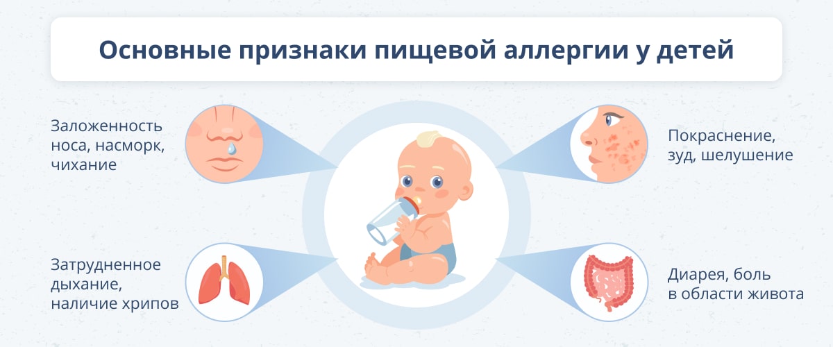 osobennosti odezhdy dlya detey s allergiey na pischevye produkty