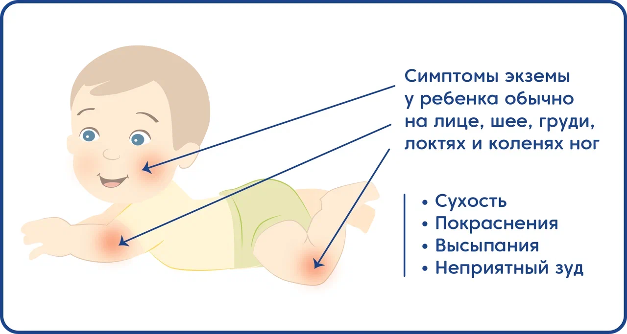 sezonnaya odezhda dlya detey s allergiey uchityvat osobennosti kozhi